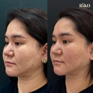 เจ้แจนoligio900 (แก้ม600เหนียง300)