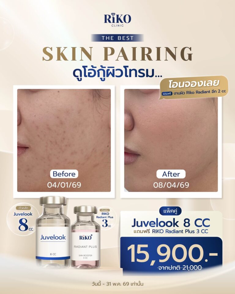 promotionskinrepairmay2026