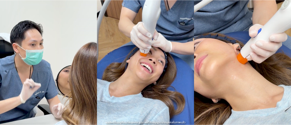 หัตถการยกกระชับผิวหน้า Riko Clinic ภาพที่ 2