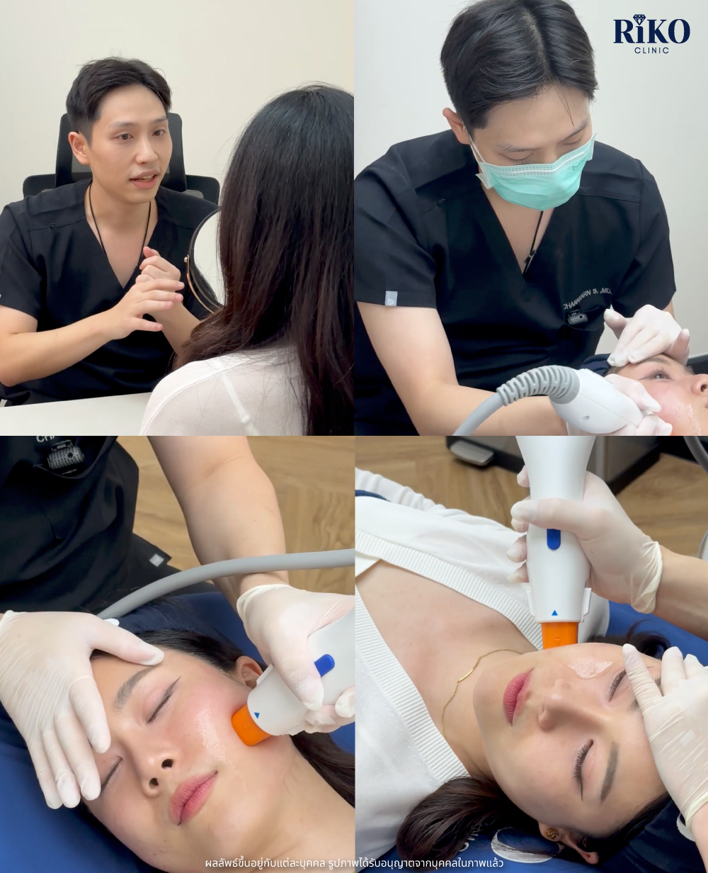 ทรีตเมนต์ Oligio โอลิจิโอ กระชับผิวหน้า Riko Clinic ภาพที่ 3