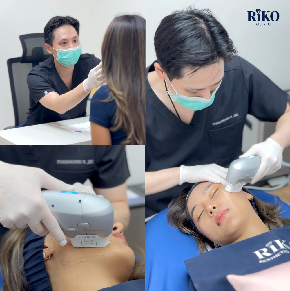 ทรีตเมนต์ Ultraformer III ยกกระชับผิวหน้า Riko Clinic ภาพที่ 2
