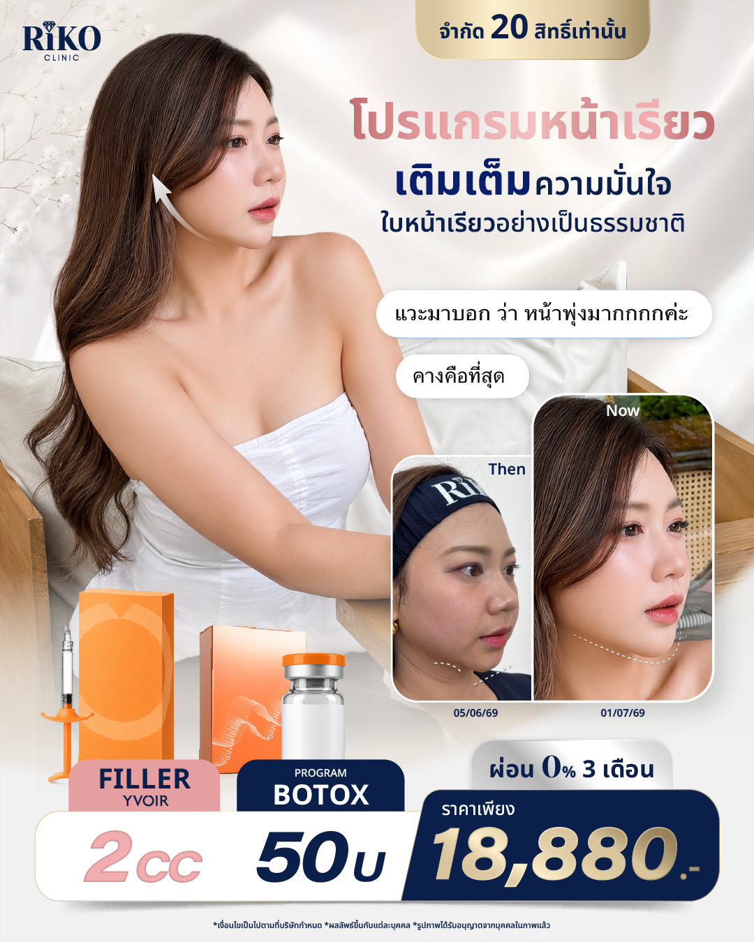 เปรียบเทียบฟิลเลอร์และโบท็อกซ์ Filler Botox Riko Clinic ภาพที่ 1