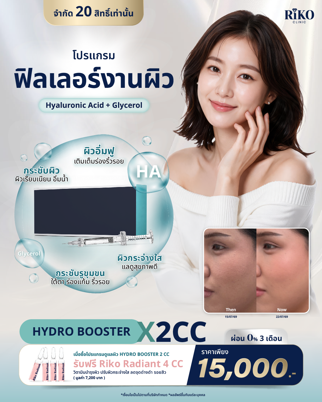 ทรีตเมนต์ไฮโดรบูสเตอร์ Hydrobooster เติมน้ำให้ผิวหน้า Riko Clinic ภาพที่ 1