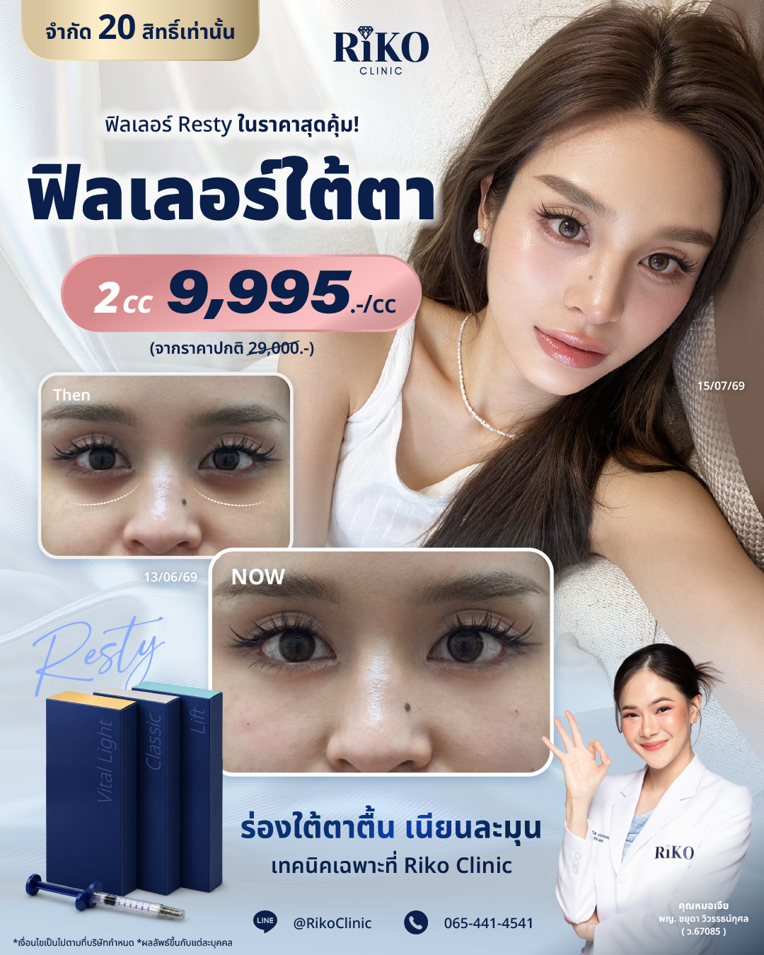 Filler_4-5_UnderEyes