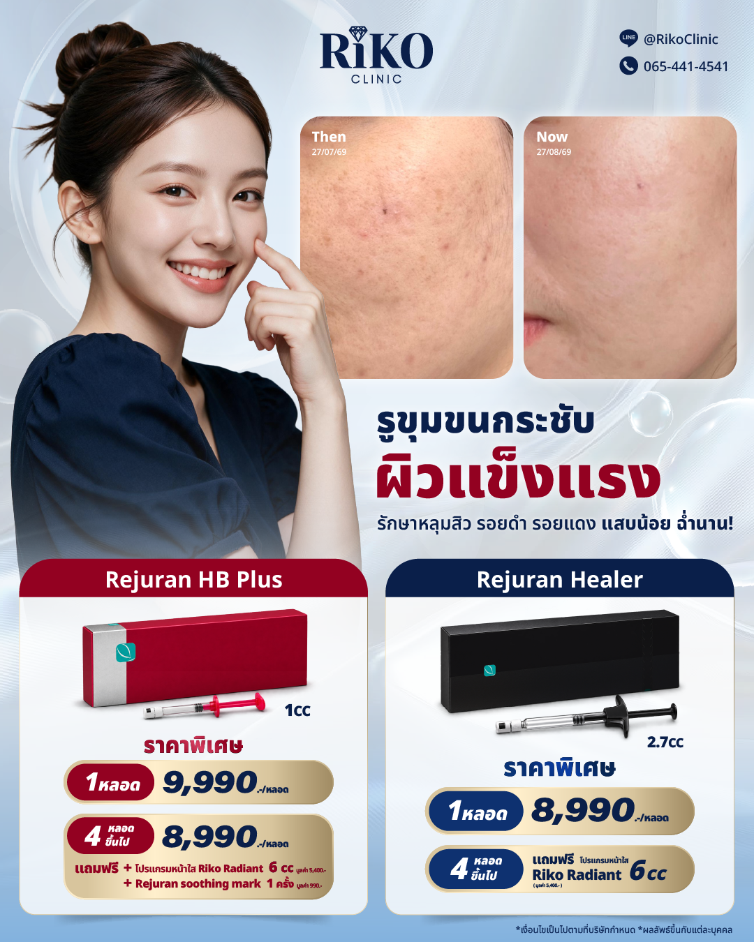 Rejuran_4-5